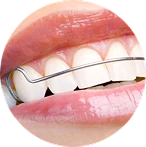 Cosmetic dentistry